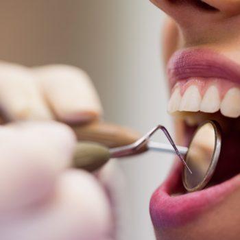 cómo prevenir la aparición de caries
