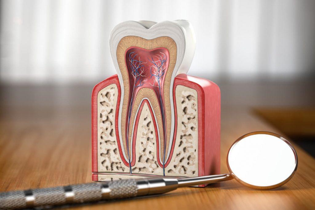 Cuidados tras una endodoncia