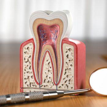Cuidados tras una endodoncia
