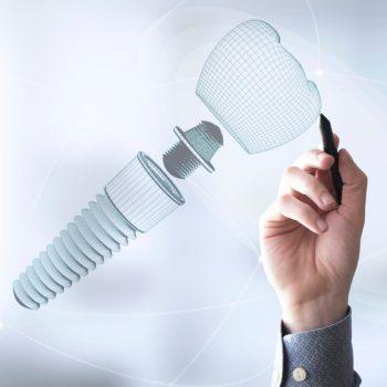 mejor época para poner implantes