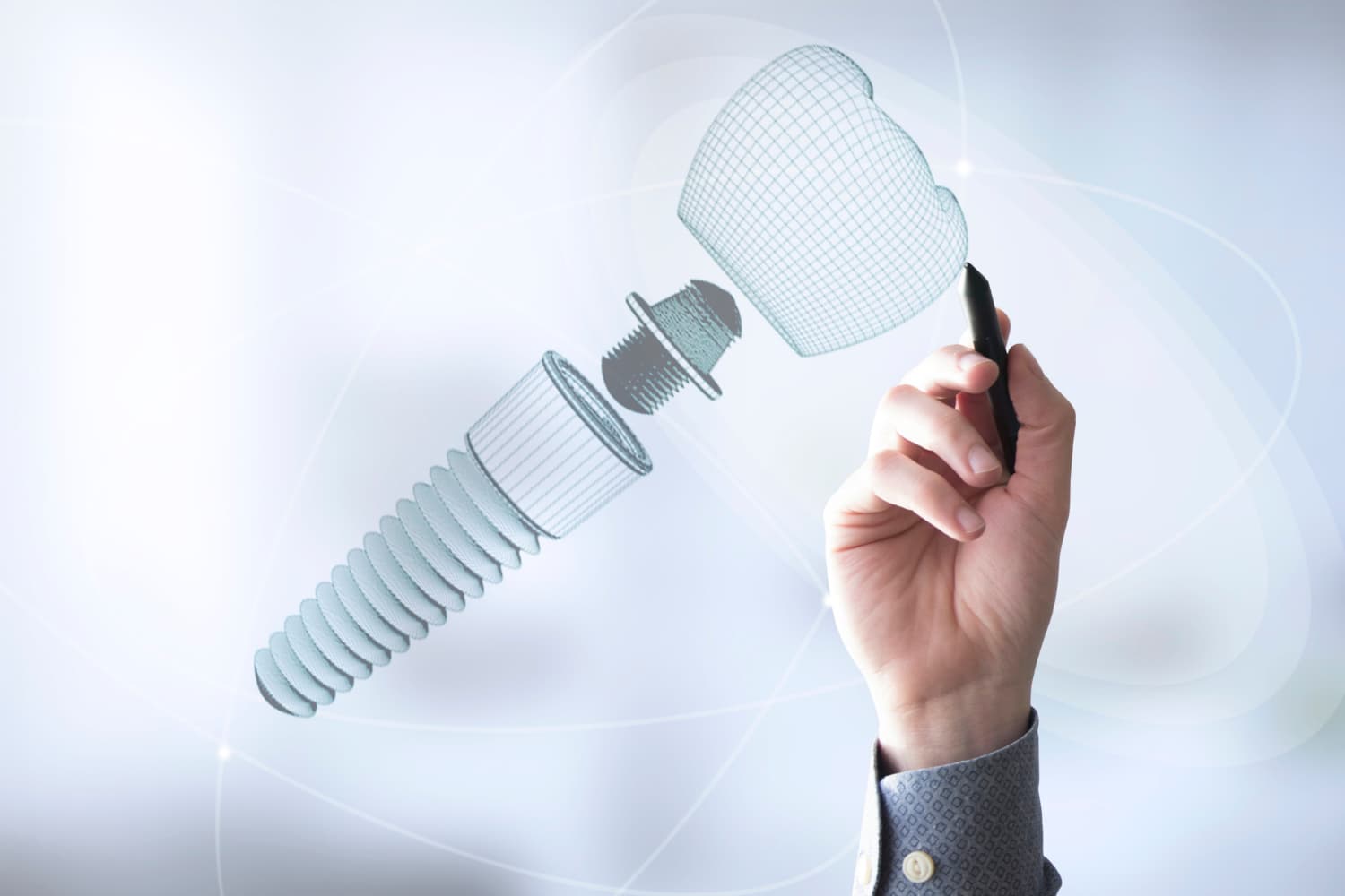 mejor época para poner implantes