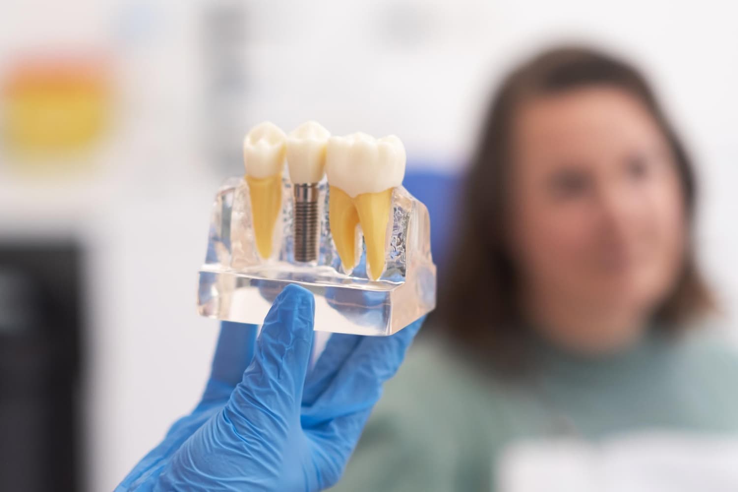 leyendas urbanas sobre implantes dentales