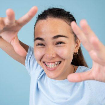 brackets e invisalign