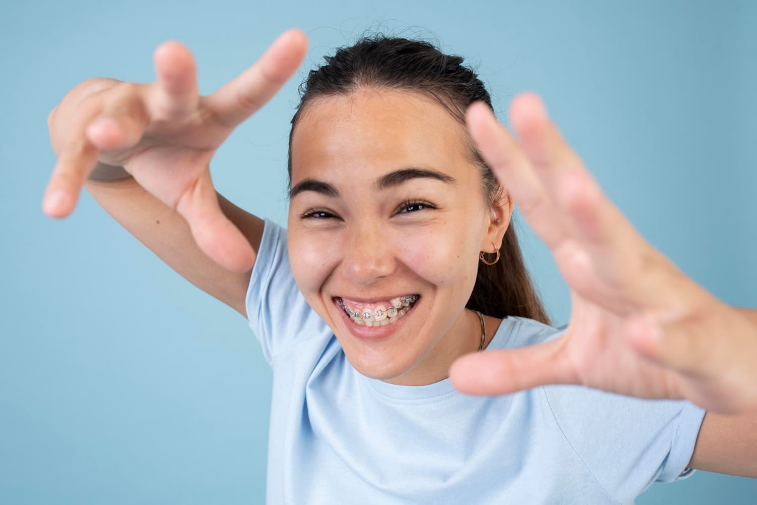 brackets e invisalign