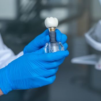 Implantes dentales