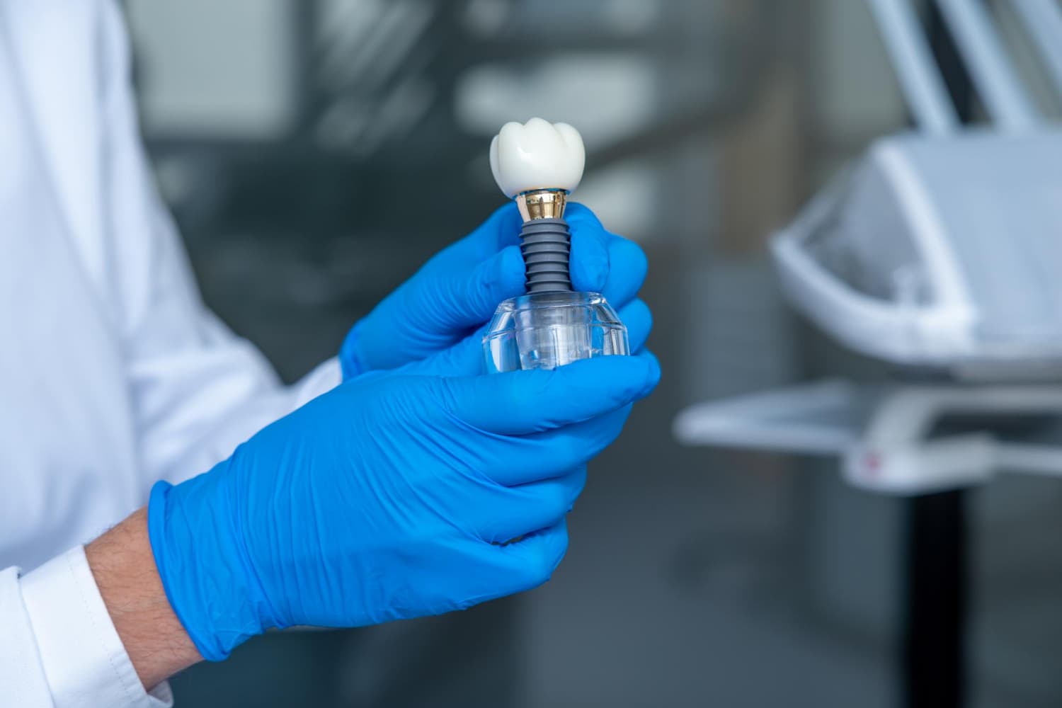 Implantes dentales