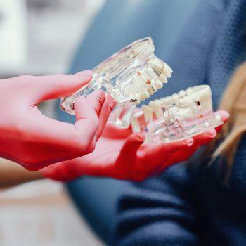 beneficios de los implantes subperiósticos