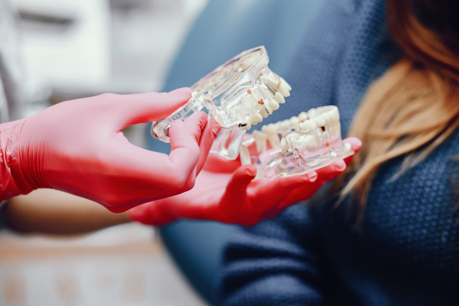 beneficios de los implantes subperiósticos